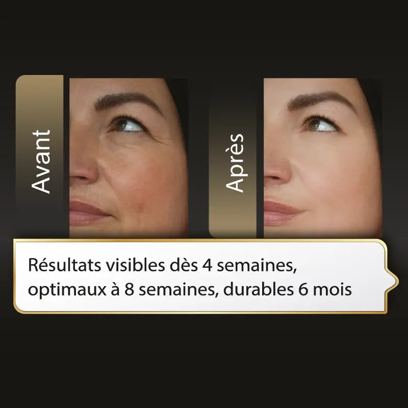 Boite de 20 Sachets buvables - Collagenlift®